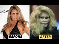 15 Celebrity Plastic Surgery Disasters