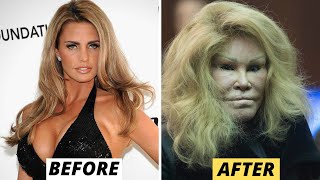15 Celebrity Plastic Surgery Disasters