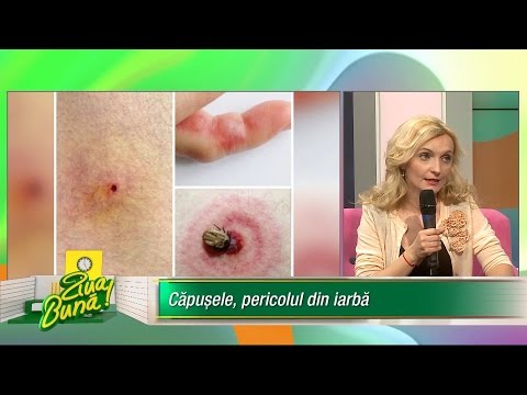 Cum prevenim și cum tratăm mușcăturile de insecte? Recomandări BTM