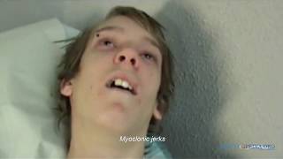 Recurrent emotional vasovagal syncope due to piercing