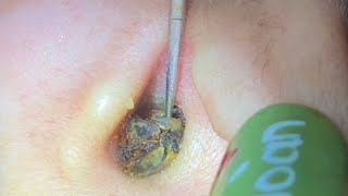 [問卦] 台灣為何不引舉辦耳光大賽？