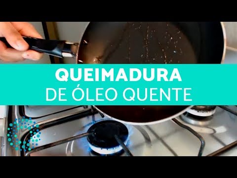 5 HOMEMADE REMEDIES FOR HOT OIL BURN