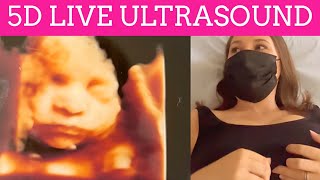 5D LIVE ULTRASOUND 3RD TRIMESTER PREGNANCY