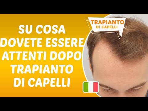 Su cosa dovete essere attendi dopo Trapianto di Capelli - Dr. Hamid AYDIN
