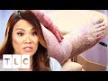 Treating The Most Extreme Case Of Scaly Skin! | Dr. Pimple Popper: This Is Zit