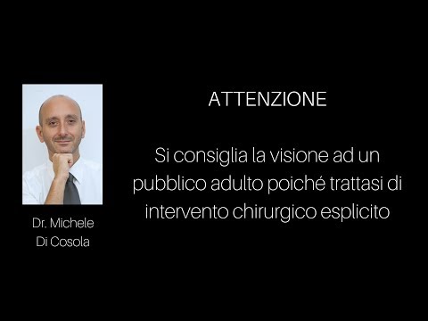 Yoga per il trattamento della scheda video lombare ernia Bendaggio elastico sul video caviglia