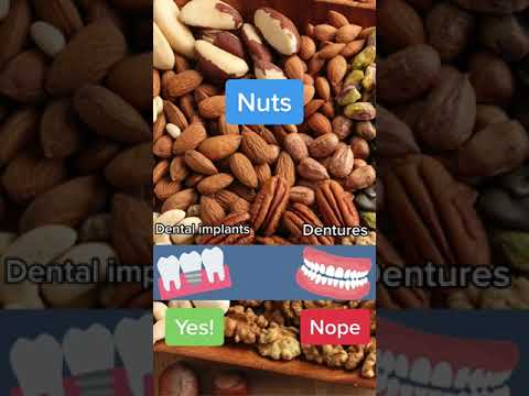 FOODS YOU CAN EAT WITH IMPLANTS VS DENTURES