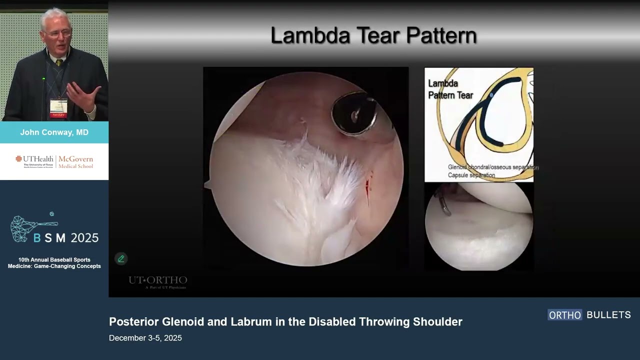 Posterior Glenoid and Labrum in the Disabled Throwing Shoulder_John Conway MD