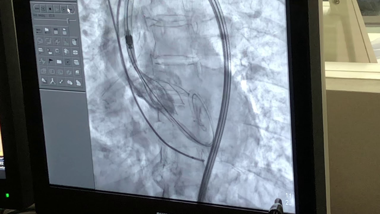 Karim Yarek Juarez Escobar-17