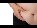 Liposuction Surgery