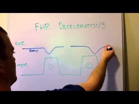Fetal Heart Rate Decelerations (Early, Late, Variable)