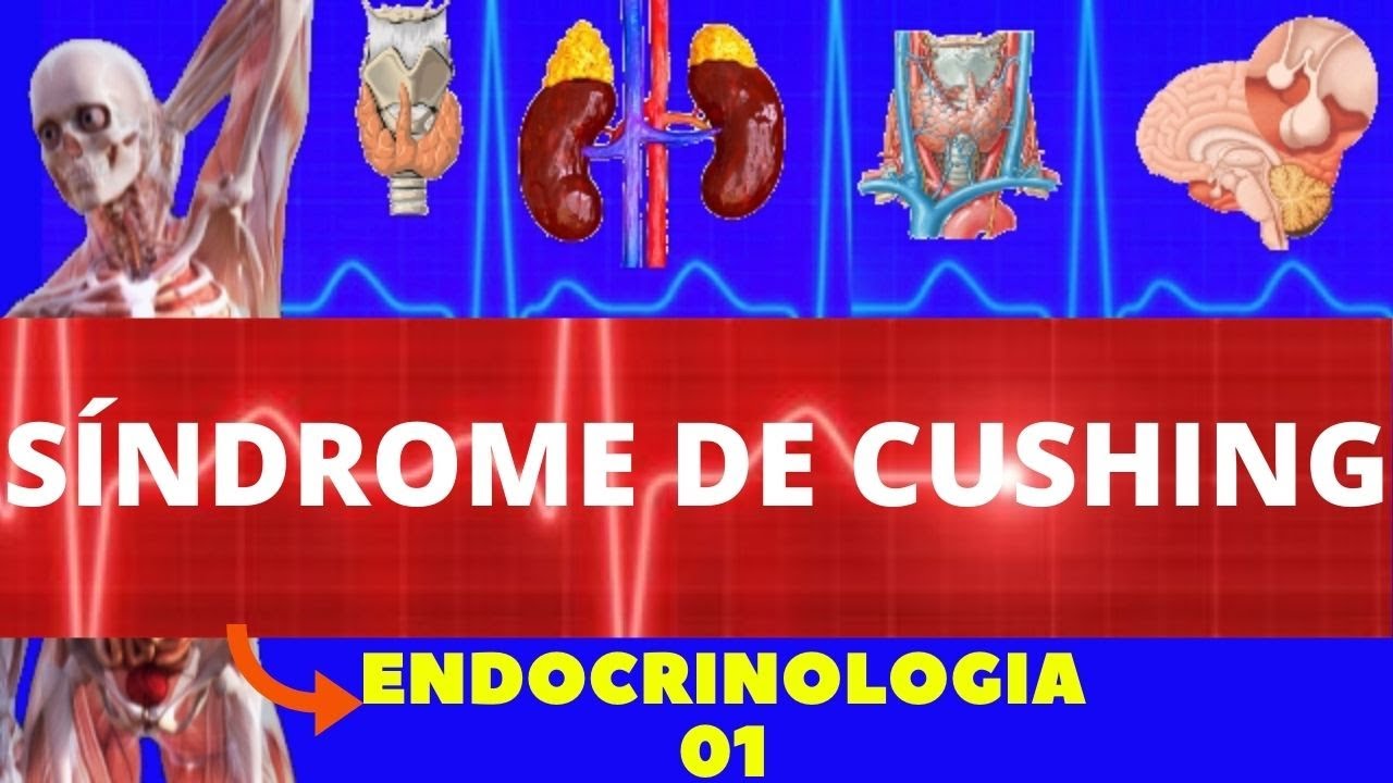 SÍNDROME DE CUSHING (CAUSAS ,SINTOMAS ,DIAGNOSTICO, TRATAMENTO) - ENDOCRINOLOGIA