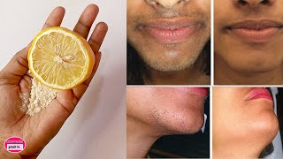 Remove unwanted hair permanently at home in 3 days with Lemon Home remedy / facial hair removal mask