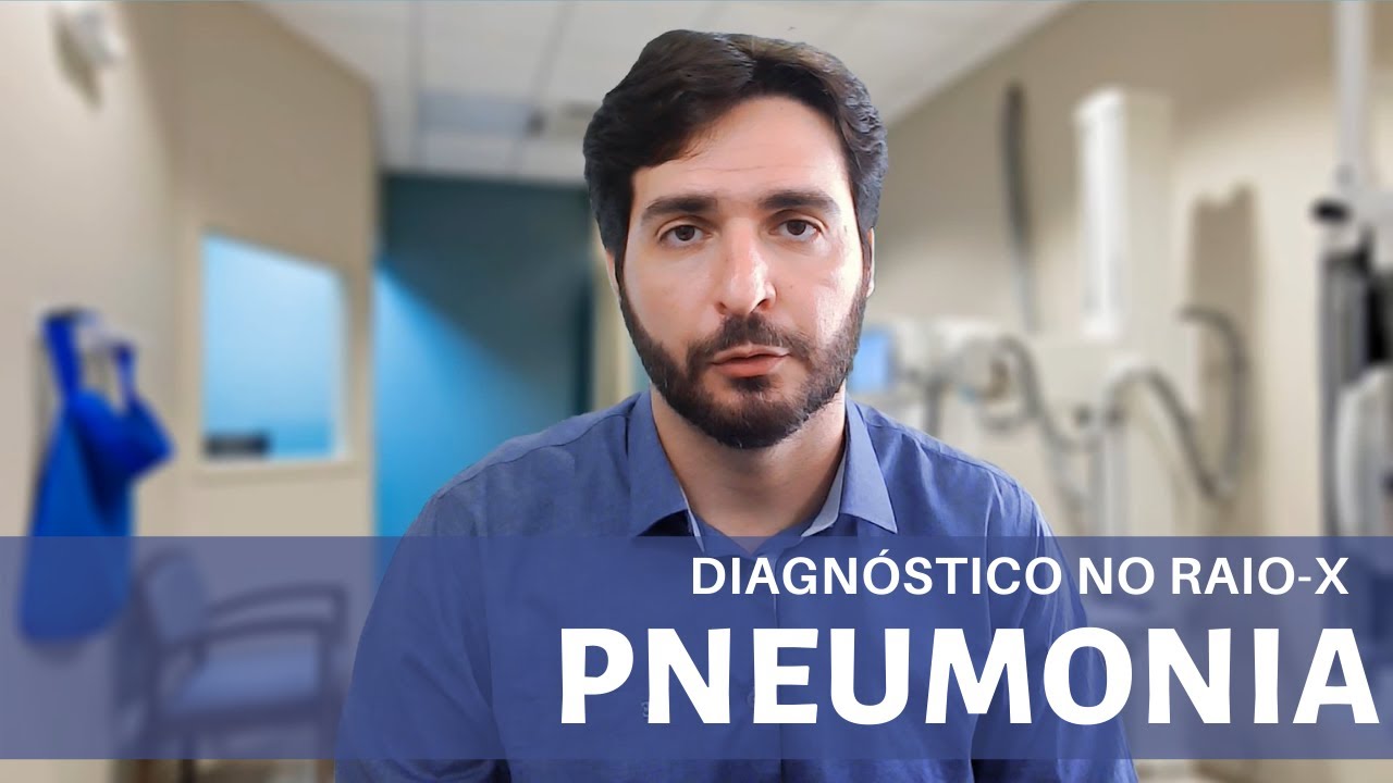 Pneumonia: 3 sinais fundamentais para o diagnóstico no Raio-X de Tórax | Galvani Filho