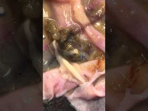 Cestode discovered by a FISH 406 alumnus