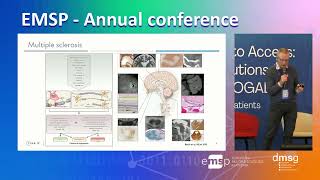Role of Clinical Trials in improving diagnosis for MS, NMSOD and MOGAD