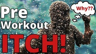 Why Does Pre Workout Make You Itch?