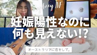 シドニーでIVF(体外受精)|陽性判定、でも胎嚢が見えない..PUL(部位不明妊娠)、子宮外妊娠の可能性も!?