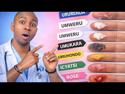 MENYA AMABARA Y'AMAVANGINGO N'ICYO ASOBANUYE KU BUZIMA BWAWE