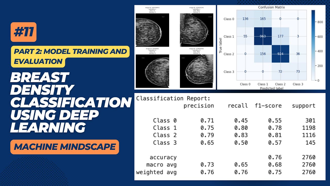 11 | Breast Density Image Classification Using Python | Part 2 | Kaggle | Train and Evaluate Model