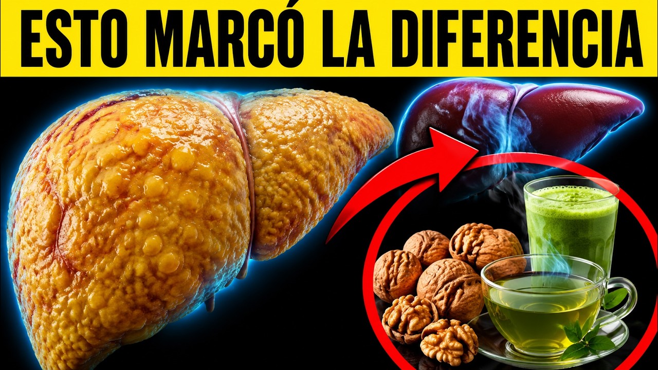 El protocolo que redujo 40% la GRASA del HÍGADO
