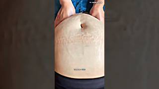 Download lagu Abdominal Massage Using This Technique Can Effectively Relieve Bloating‼️ #shorts #massage mp3