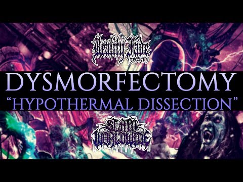 DYSMORFECTOMY - HYPOTHERMAL DISSECTION [OFFICIAL ALBUM STREAM] (2017) SW EXCLUSIVE