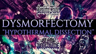 DYSMORFECTOMY - HYPOTHERMAL DISSECTION [OFFICIAL ALBUM STREAM] (2017) SW EXCLUSIVE