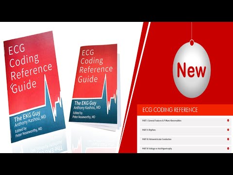 EKG Interpretation Resource | The EKG Guy - www.ekg.md