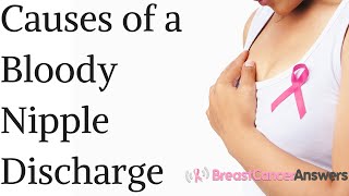 Bloody Nipple Discharge, What Are the Causes