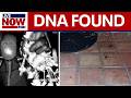 DNA Found At Nancy Guthrie S Home Is Not Hers Sheriff Says