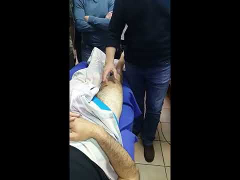 Виды эндопротезов для коленного сустава От суставов голд остеопак