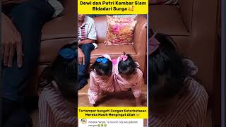 Download lagu Momen Haru! Kembar Siam Dewi & Putri Peragakan Cara Mereka Sholat 😭 #trending #kembarsiam #viral mp3