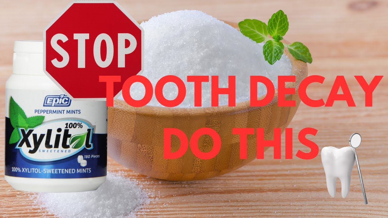 Unlock the Power of Xylitol: Natural Defence Against Tooth Decay  [Stop Cavities]