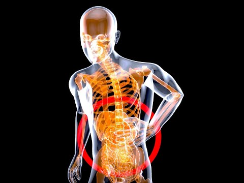 Shocking Truth Behind Zollinger‑Ellison Syndrome – Ulcers, Tumors & Silent Signals!