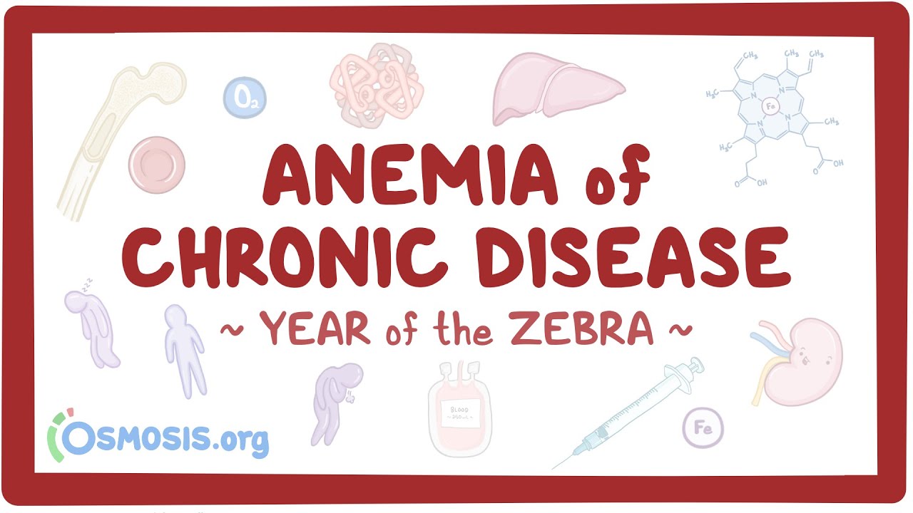 Anemia of chronic disease (Year of the Zebra)