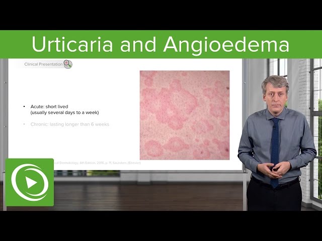 Výslovnost videa Angioedema v Anglický