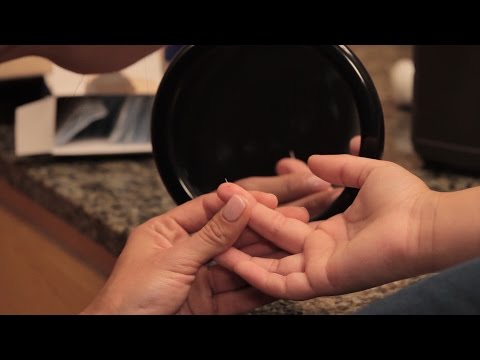 How to remove a splinter