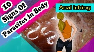 Don&#39;t Ignore These Early Symptoms of Parasites in Your Body