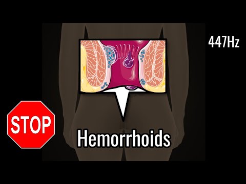 447Hz STOP HEMORRHOIDS!!! Healing Music for Internal and External Hemorrhoids. Healing Frequency.