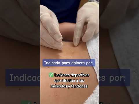 Oscar David Perales  Alanoca-15