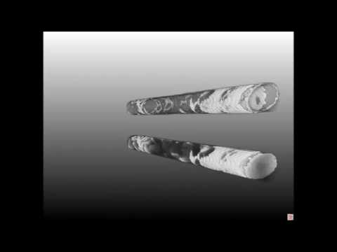 Endoscopy of trabecular bone for intraoperative registration