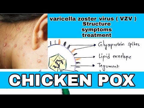 Typhoid fever Salmonella typhi Causes symptoms diagnosis treatment Bio science