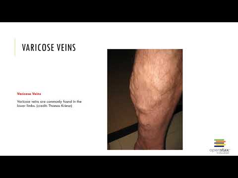 Chapter 20 Recorded Lecture