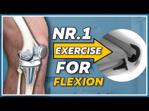 Die Übung Nr. 1 zur Wiederherstellung der Kniebeugung nach einer Kniegelenksersatzoperation