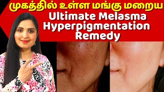 மங்கு மறைய இதை செய்யுங்க / How To Get Rid of HYPER PIGMENTATITON - #Melasma #Freckles #Dark Spots