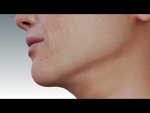 Play Video Youtube Video