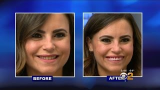 As Seen On TV: &#39;Perfect Smile Veneers&#39; Not So Perfect
