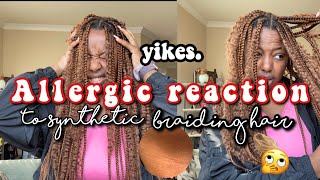 ALLERGIC REACTION TO SYNTHETIC BRAIDING HAIR!?- Remedy+Relief