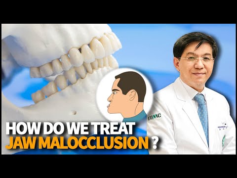 How do we treat Jaw Malocclusion and Temporomandibular Disorder? What are the possible symptoms?